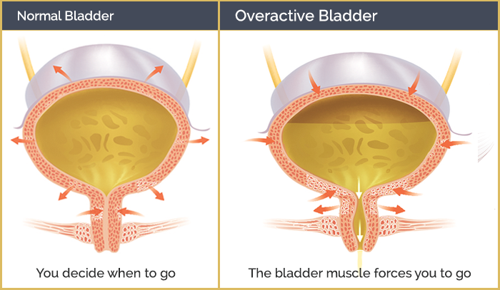 the-best-herbal-remedies-and-supplements-for-bladder-control-in-2021